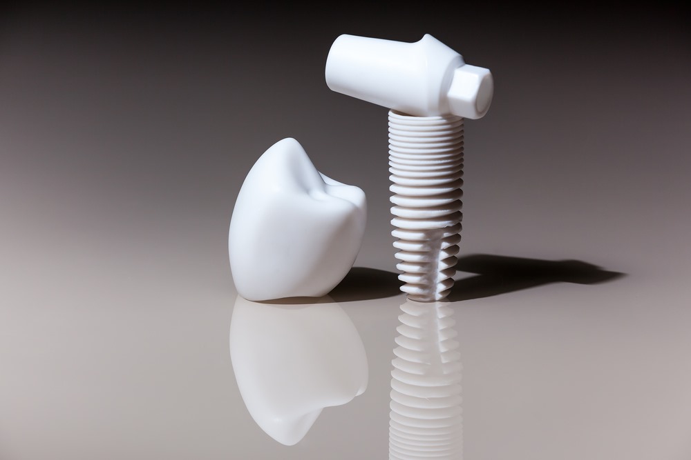 Implantat Typen – Keramik oder Titan, Zahnarztpraxis Dr. Waas München